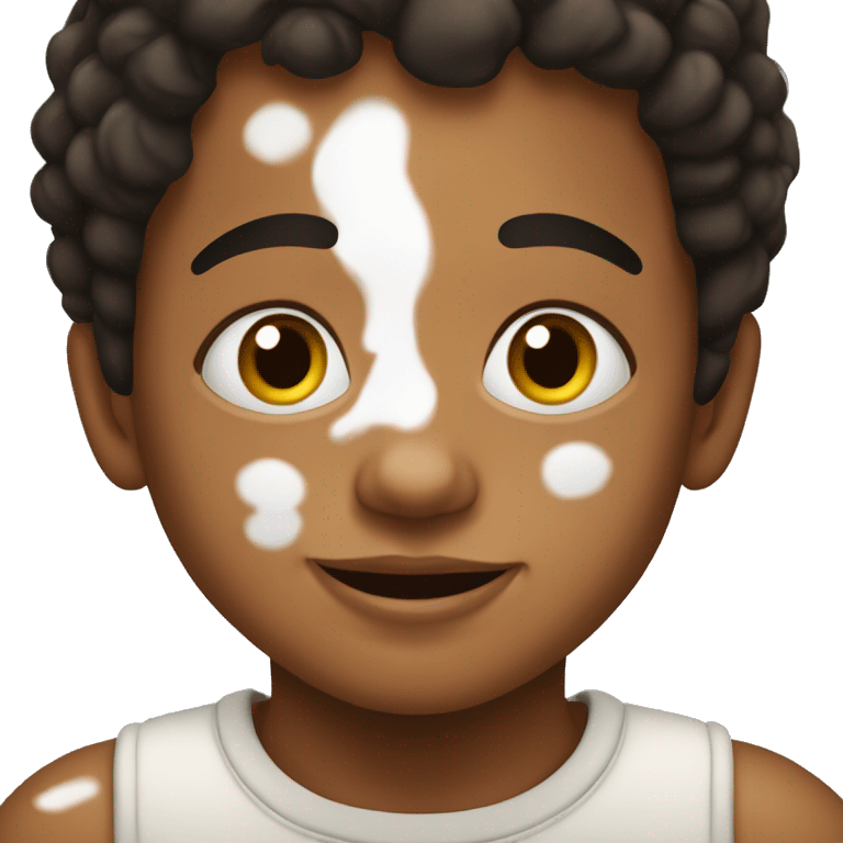 niño con vitiligo emoji