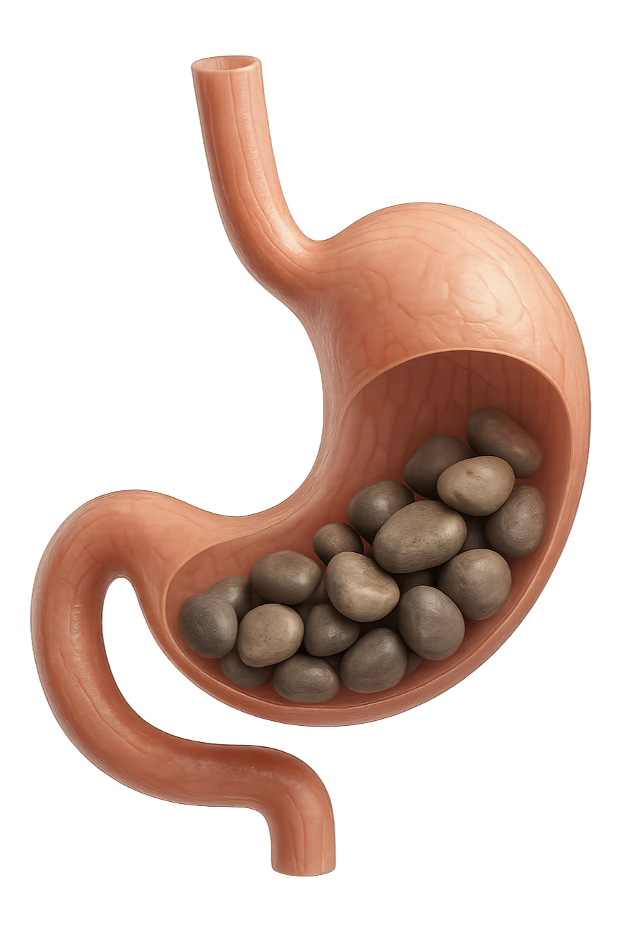 Sassi nello stomaco durante la digestione in 3d realistica sticker