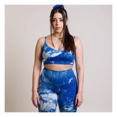 Realistic style image of a woman in sportswear inspired by the two reference photos, showing diffuse water retention on the entire leg with visible subcutaneous fluid accumulation. Clear anatomical details, front view, neutral background, medical realistic appearance. sticker