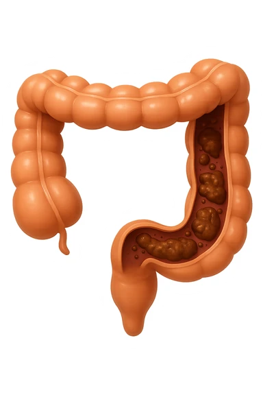 EMOJI STILE IPHONE DI UN TRATTO DI COLON INTESTINALE CHE FLUTTUA IN ARIA CON ALL'INTERNO DELLE FECI, IPERREALISTICO 4K sticker