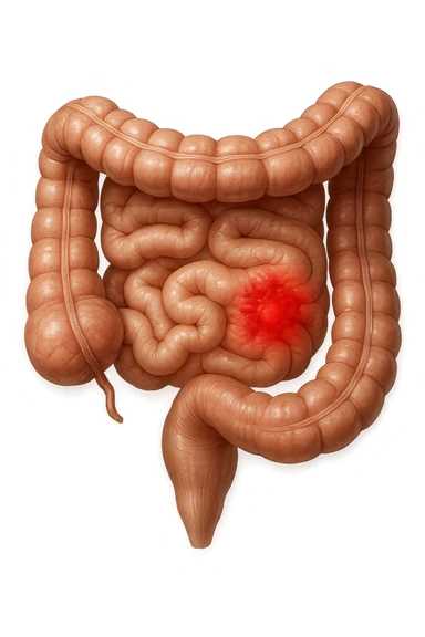intestino anatomico realistico con red spot di infiammazione, IPERREALISTICO 4K sticker