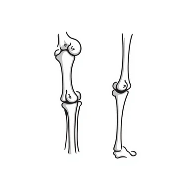 anatomical drawing of knee bones showing patella, femur, tibia, and fibula with labels sticker