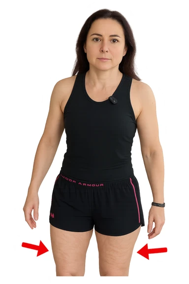 Donna con cellulite sulle cosce indica le cosce che sono infiammate di cellulite con frecce ad indicare  senza mano alzata come in foto. sticker