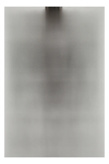 Create a series of 5 vertical images of a man (reference photo) with widespread joint pain, highlighting inflammation with an anatomical view. Show red zones on the joints, medical style, anatomical details, hyperrealism, variation 5. sticker