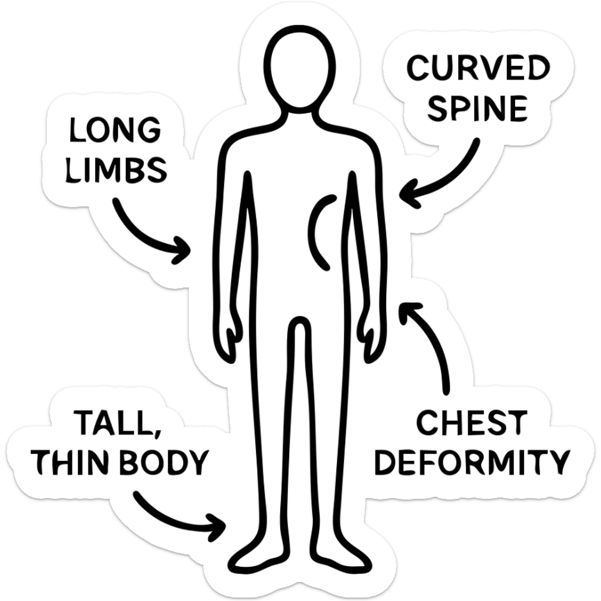 outline illustration of a Marfan syndrome patient, emphasizing long limbs, tall thin body, curved spine, and chest deformity, with labeled arrows, suitable for educational use sticker