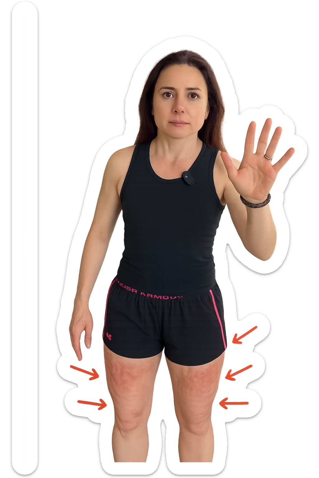 Donna con cellulite sulle cosce indica le cosce che sono infiammate di cellulite con frecce ad indicare  sticker