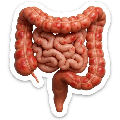 intestino umano anatomico con rossori sparsi sul colonm, iperrealistico 4k sticker