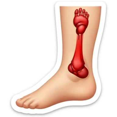 ankle injury from slippery floor sticker