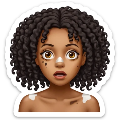 Emoji of a very shocked black female with vitiligo (alot of vitiligo patches) sticker