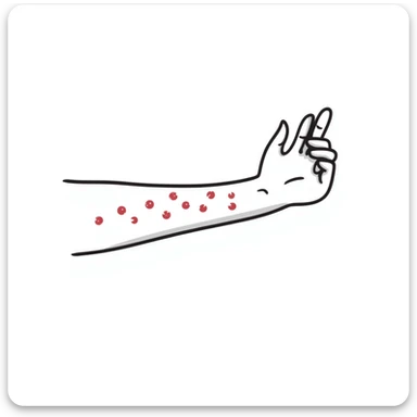 Detailed drawing of arm showing allergy skin prick test on forearm with small red welts, hand with all 5 fingers visible sticker