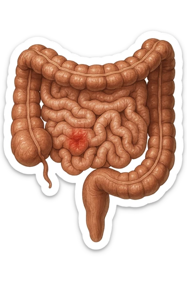 intestino anatomico realistico con red spot di infiammazione sticker