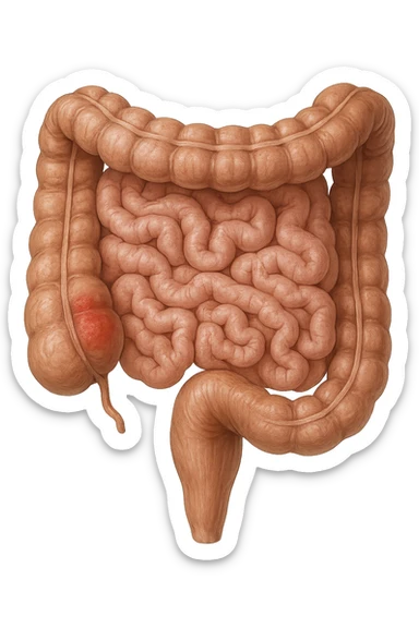 intestino anatomico realistico con red spot di infiammazione sticker