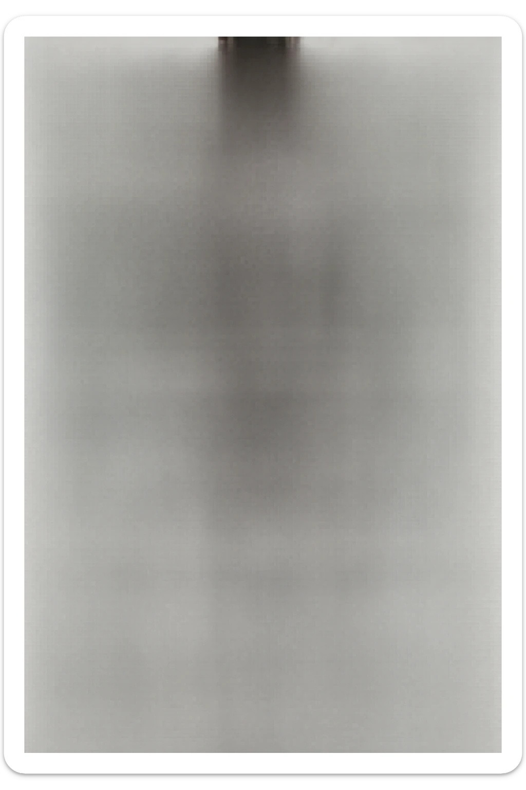 Create a series of 5 vertical images of a man (reference photo) with widespread joint pain, highlighting inflammation with an anatomical view. Show red zones on the joints, medical style, anatomical details, hyperrealism, variation 5. sticker