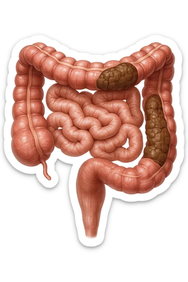 intestino umano anatomico realistico con feci bloccate nel colon, iperrealistico 4k sticker
