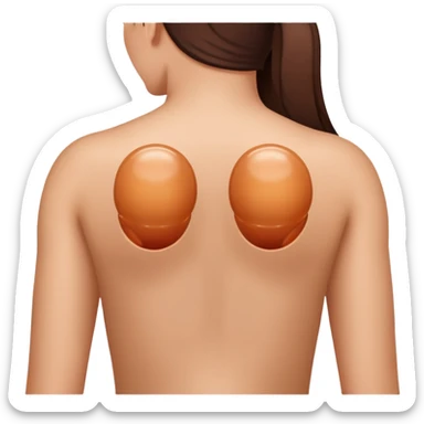 Cupping therapy on back sticker