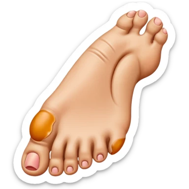 missing toe of a foot sticker