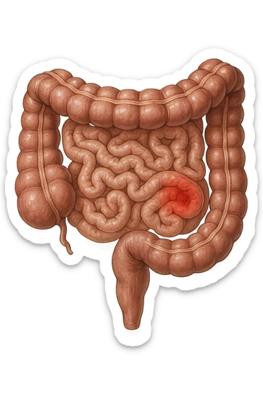 intestino anatomico realistico con red spot di infiammazione sticker