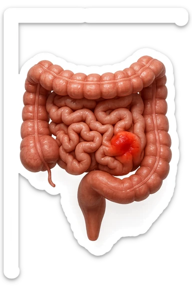 intestino anatomico realistico con red spot di infiammazione, IPERREALISTICO 4K sticker