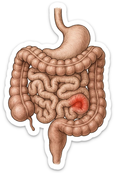intestino anatomico realistico con red spot di infiammazione sticker