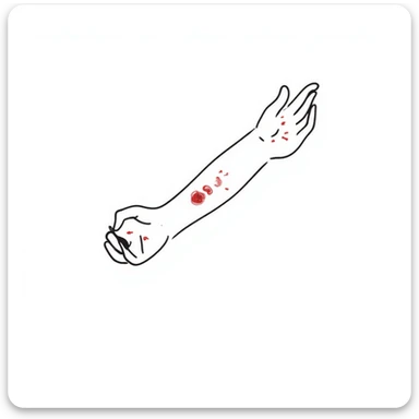 Detailed drawing of arm showing allergy skin prick test on forearm with small red welts, hand with all 5 fingers visible sticker