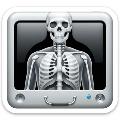 X-ray sticker
