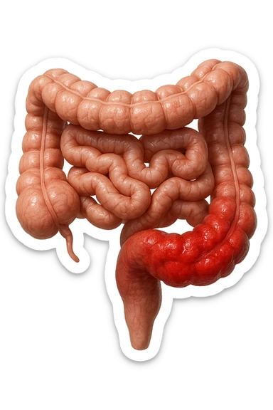 INTESTINO UMANO ANATOMICO REALISTICO INFIAMMATO, IPERREALISTICA 4K sticker