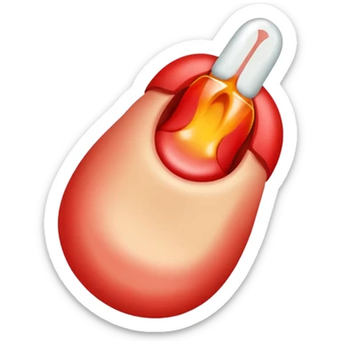 Ingrown toenail  sticker