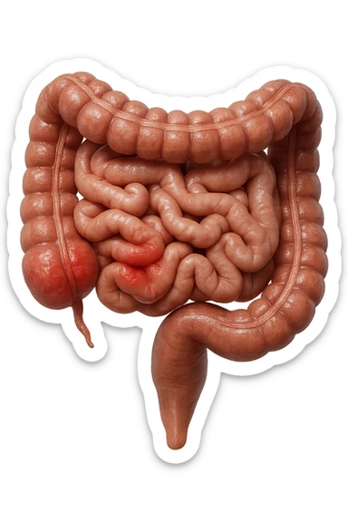 intestino anatomico realistico con red spot di infiammazione, IPERREALISTICO 4K sticker