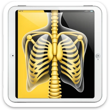 xray diagram. Yellow black sticker