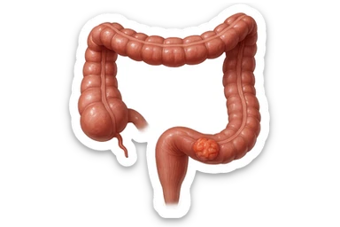 colon umano anatomico realistico malato di cancro, fai un punto visibile in cui si nota proprio la massa tumorale,+ iperrealistico 4k sticker