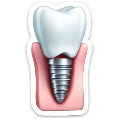 Dental implant with tooth sticker