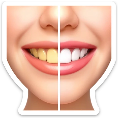 Split-screen close-up of a smile showing before and after teeth whitening, left side slightly yellow teeth, right side bright white teeth, glossy lips, soft studio lighting, high detail, dental cosmetic comparison, realistic, sharp focus. sticker