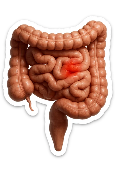 intestino anatomico realistico con red spot di infiammazione, IPERREALISTICO 4K sticker