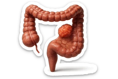 colon umano anatomico realistico malato di cancro, fai un punto visibile in cui si nota proprio la massa tumorale,+ iperrealistico 4k sticker