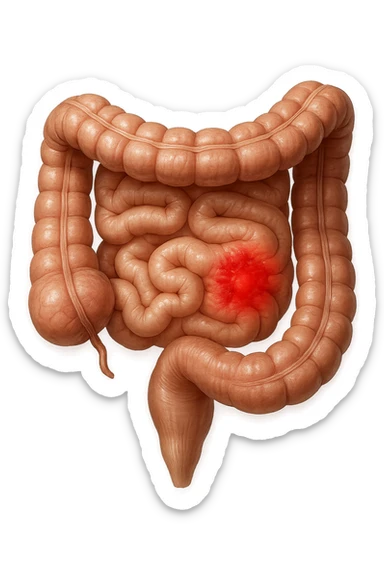 intestino anatomico realistico con red spot di infiammazione, IPERREALISTICO 4K sticker