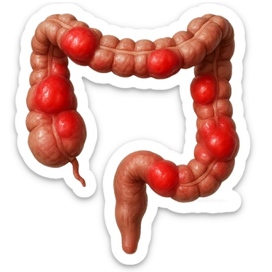 realistic human intestine, inflamed with red swollen areas, 3D effect, isolated on white background sticker