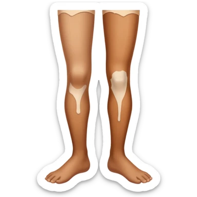 Vitiligo leg sticker