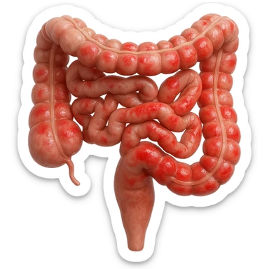 intestino umano anatomico con rossori sparsi sul colonm, iperrealistico 4k sticker