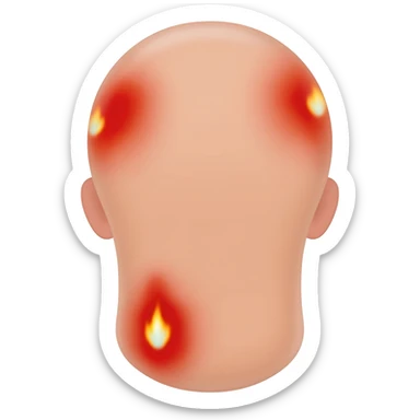 skin burns sticker