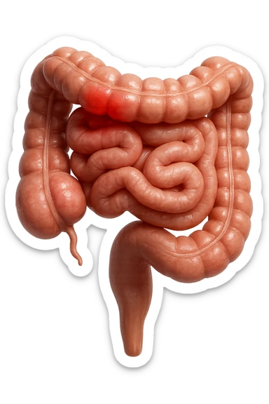 intestino anatomico realistico con red spot di infiammazione, IPERREALISTICO 4K sticker