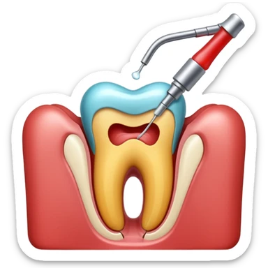Root canal sticker