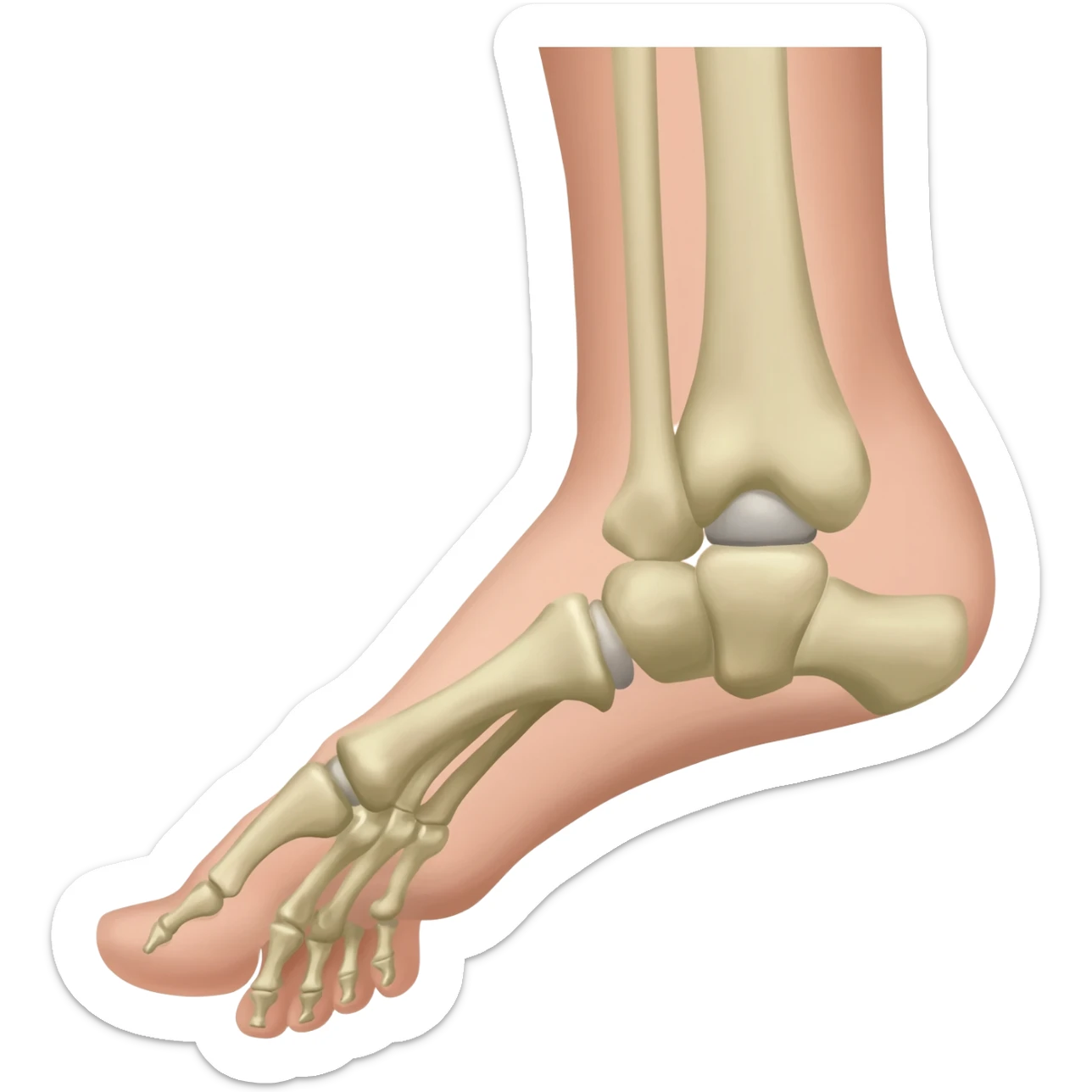 Verkürzte Achillessehne im rechten Fuß ohne Knochen zum Vergleich zum linken sticker