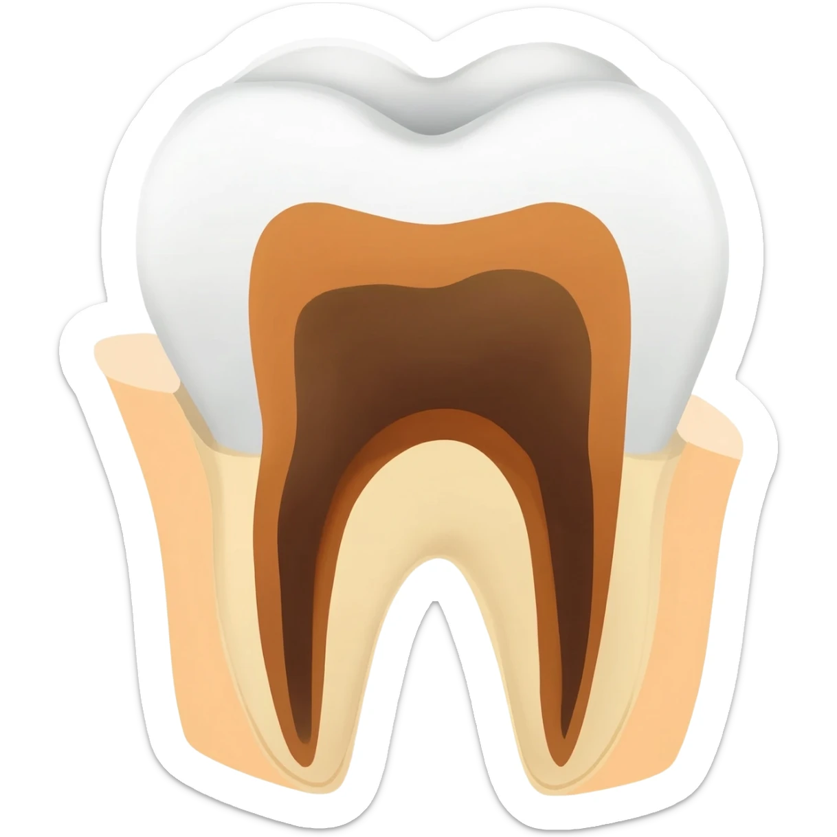 a tooth with caries, into the middle of the crown of the tooth and gettin through the tooth right to the root, and remark the borders with brown & pale orange colors, to give it more realistic shape sticker