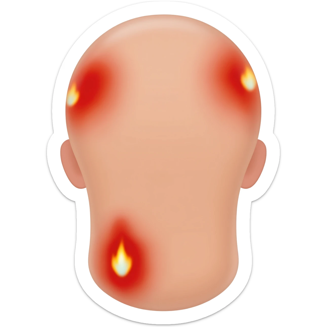 skin burns sticker