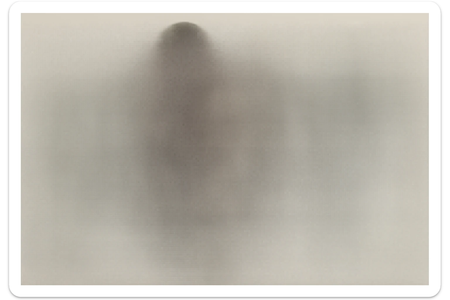 CISTIFELLEA E INTESTINO SONO COLLEGATI NEL DOLORE, SENZA SCRITTE E L'INTESTINO FALLO PERFETTO E REALISTICO, NON DISEGNATO iperrealistico 4k sticker