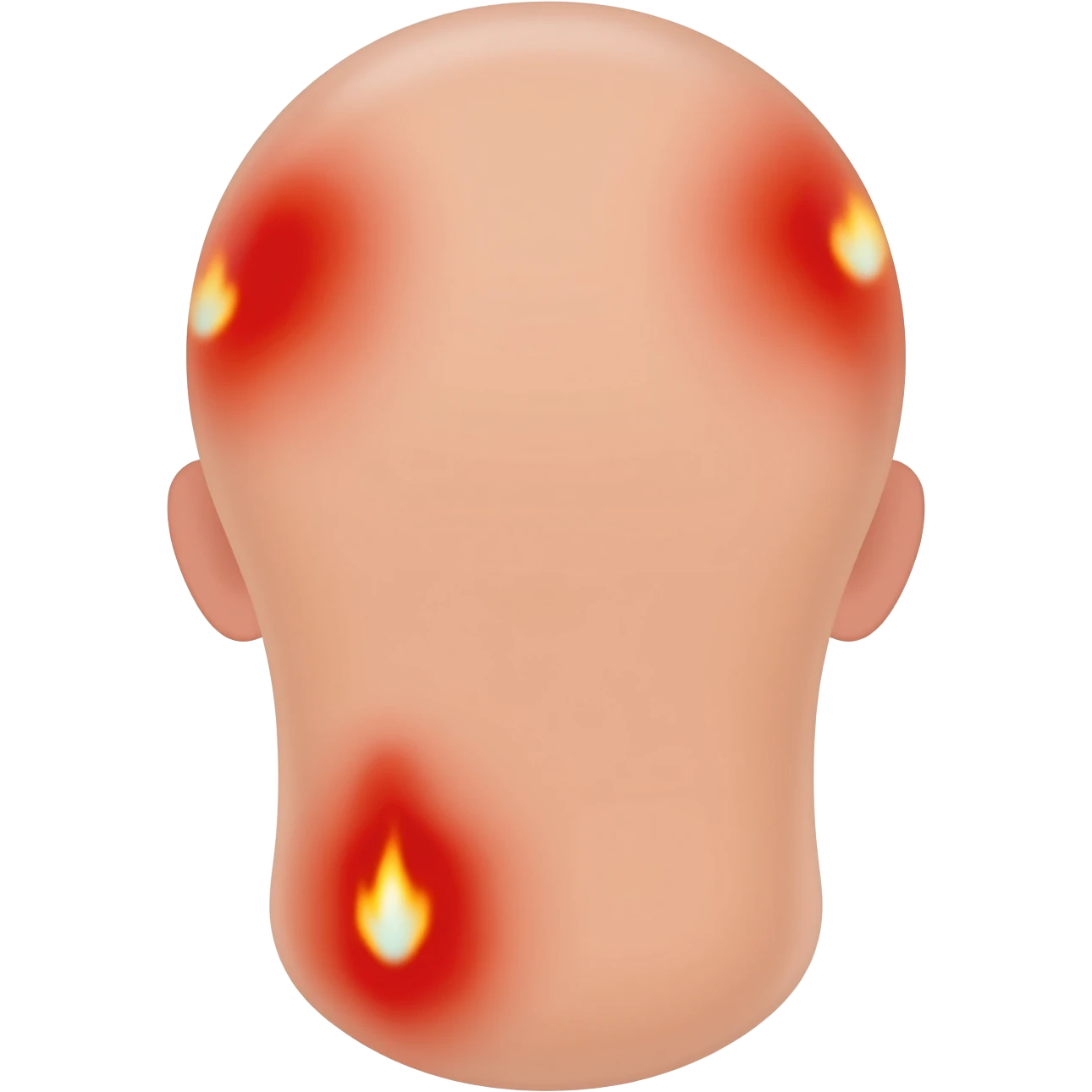 skin burns emoji