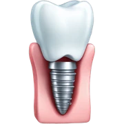 Dental implant with tooth sticker