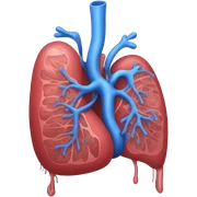 Pulmonary embolism  sticker