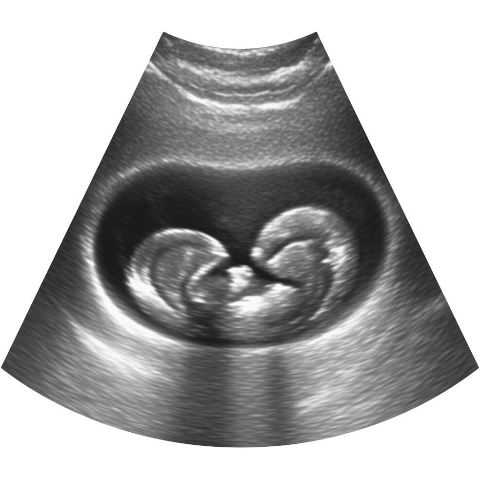 ultrasound emoji