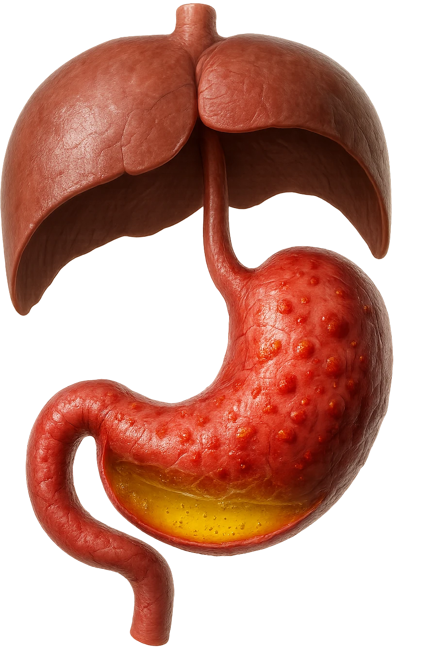 stomaco umano anatomico infiammato con acido giallo all'interno fluttua in aria insieme ad un diaframma umano, iperrealistico 4k, isolato su sfondo bianco emoji